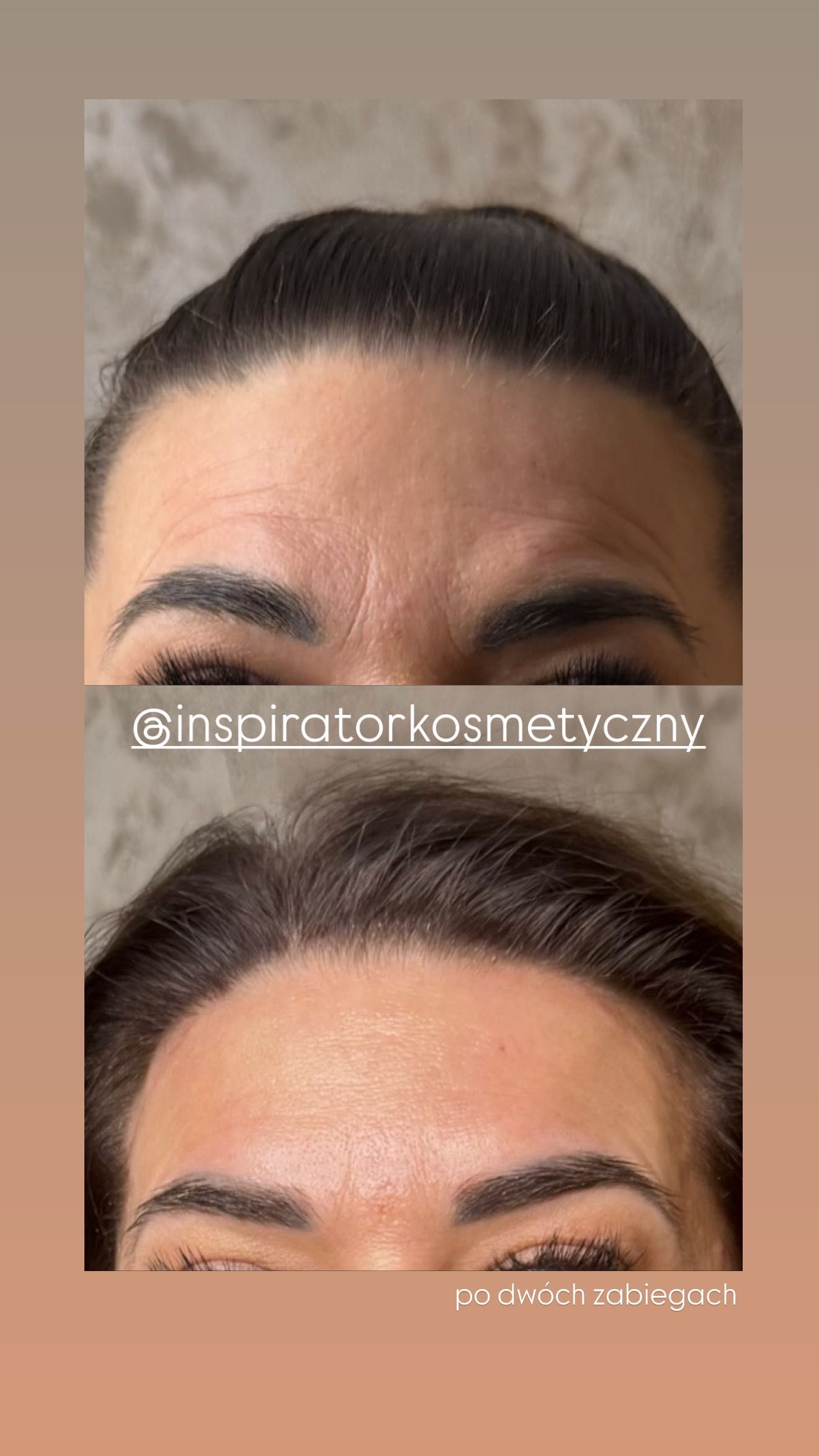 Efekty zabiegów kosmetycznych Inspirator